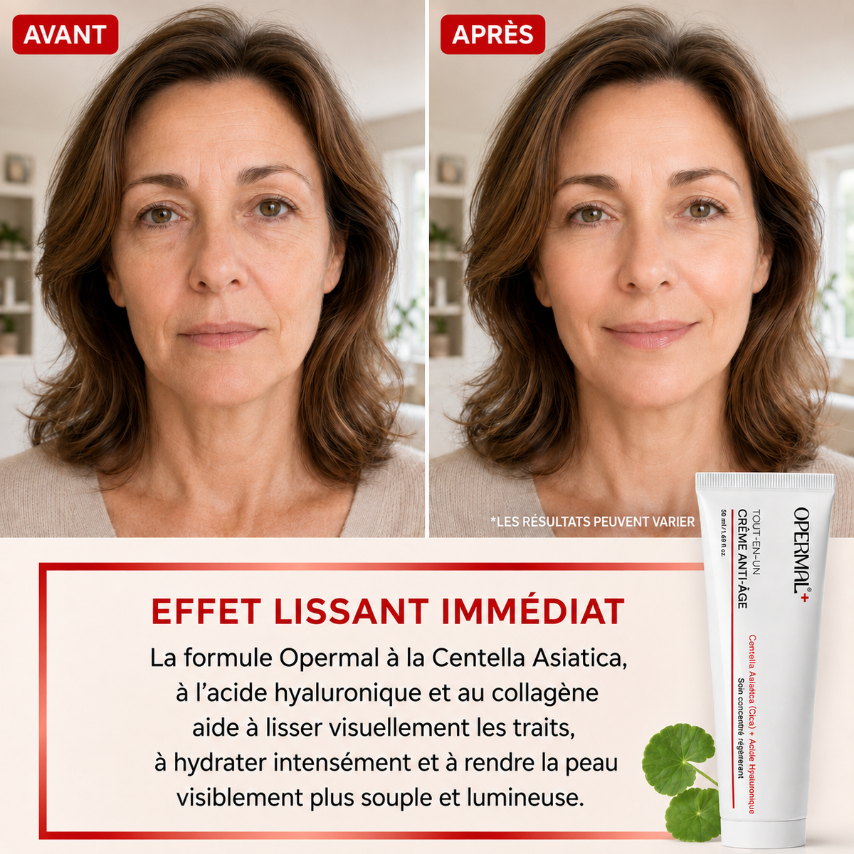 Crème anti-âge tout-en-un Opermal™