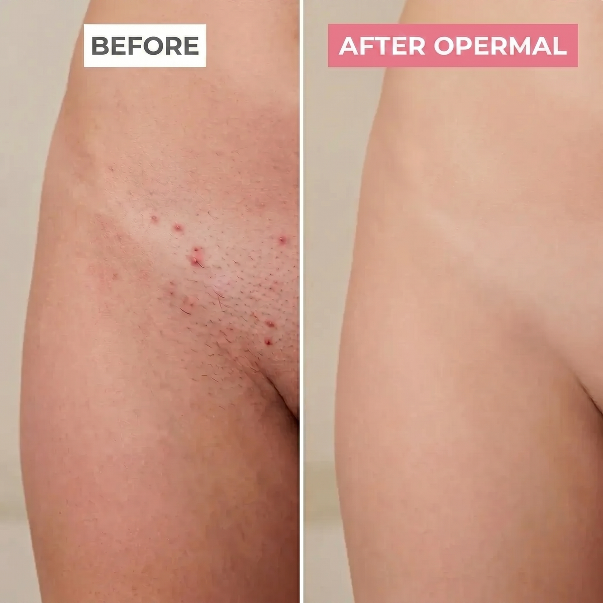 2-in-1 Razor | Gentle on All Sensitive Areas